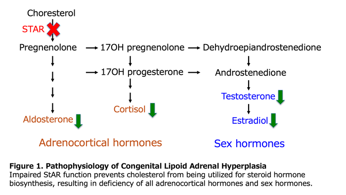 Figure 1. Pathophysiology of Lipoid Congenital Adrenal Hyperplasia